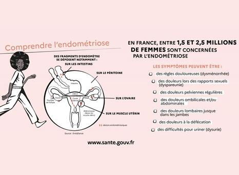 Comprendre la maladie de l'endométriose